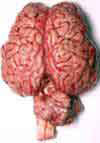 A human brain without the human
